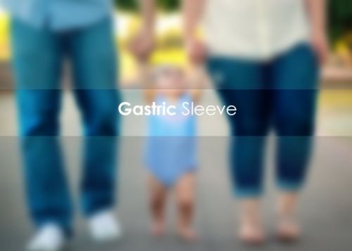 Metabolic Surgery - Gastric Sleeve'