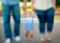 Metabolic Surgery - Gastric Sleeve