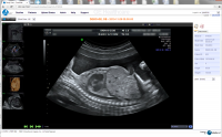 Ultrasound Imaging from Studycast