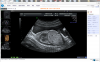 Ultrasound Imaging from Studycast'