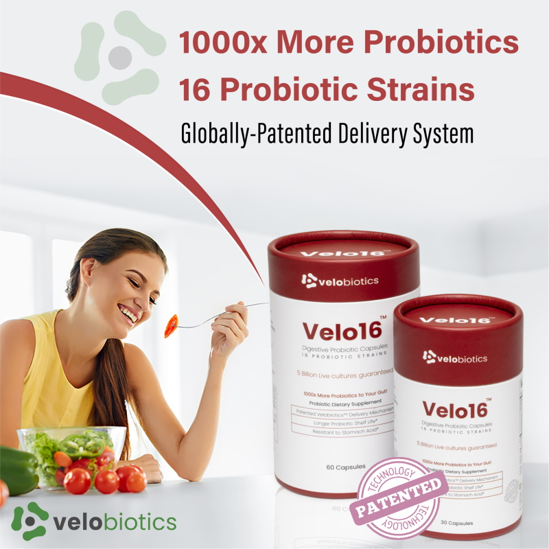 Velo16 - Key Points'