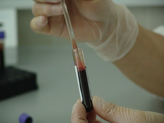Influenza Diagnostic Tests Market'