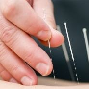 Acupuncturist'