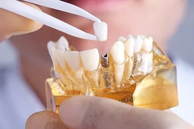 Best Dentist In Mt Kisco'