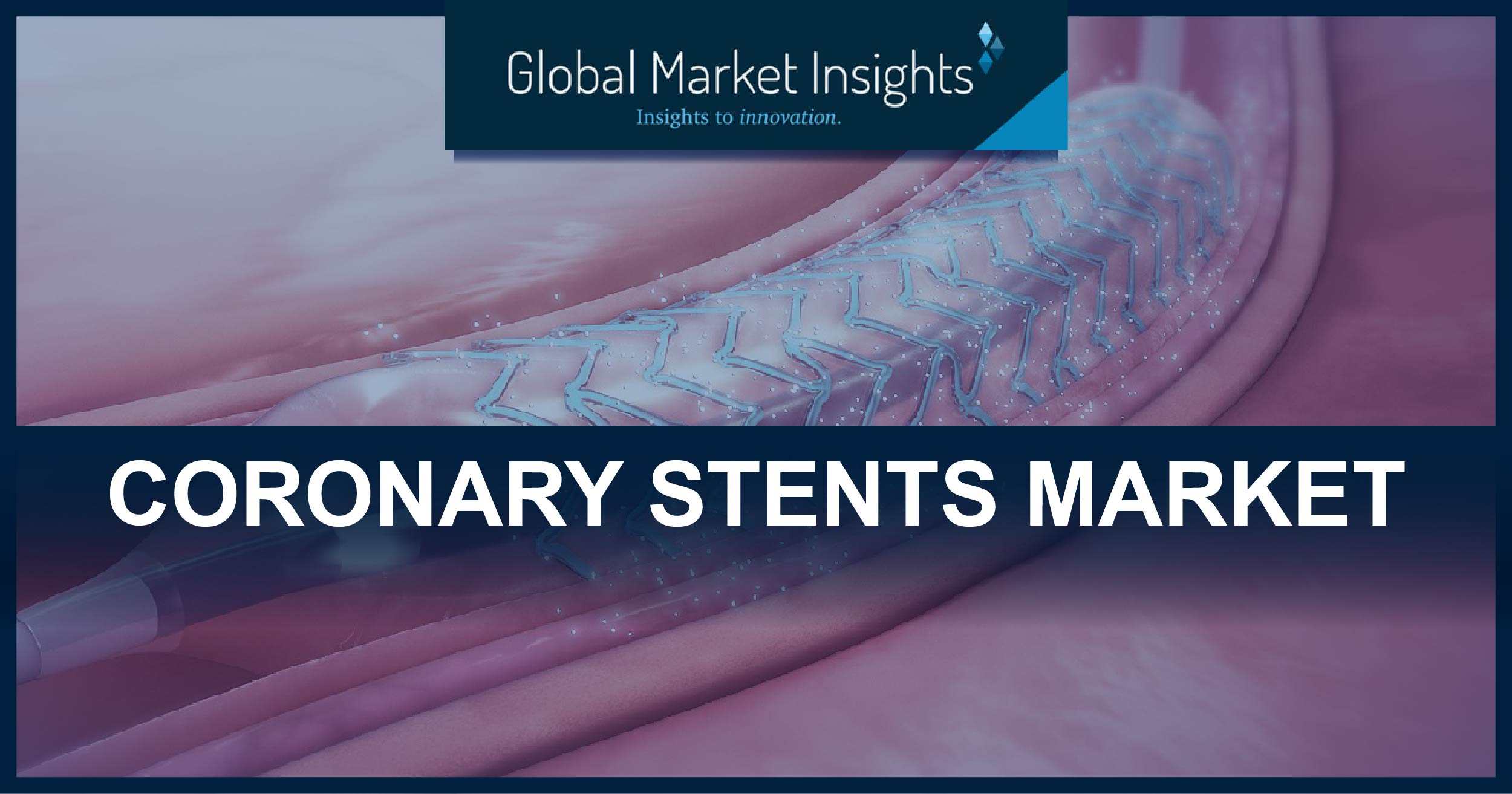 Coronary Stents Market Share Statistics 2025'