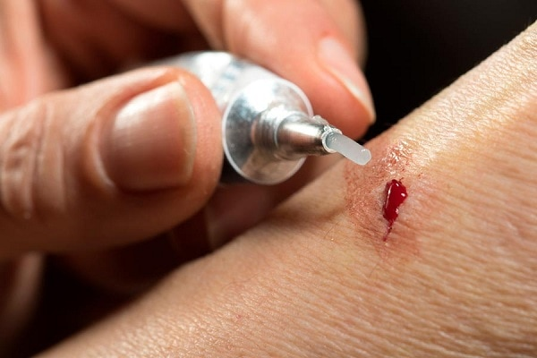 Surgical Glue Market