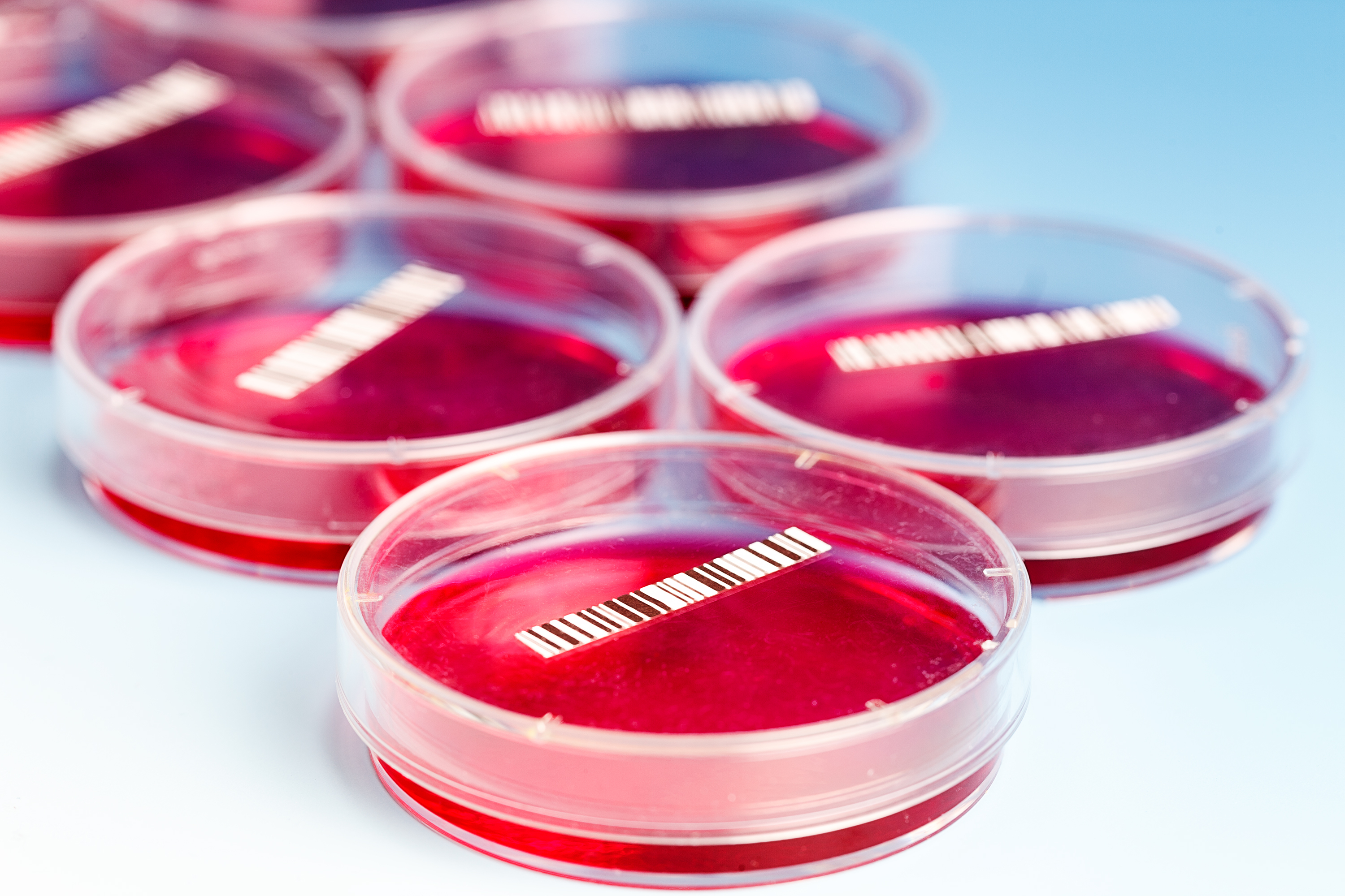 Blood Culture Test Market'