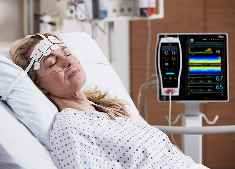 Cerebral Somatic Oximeters Market'