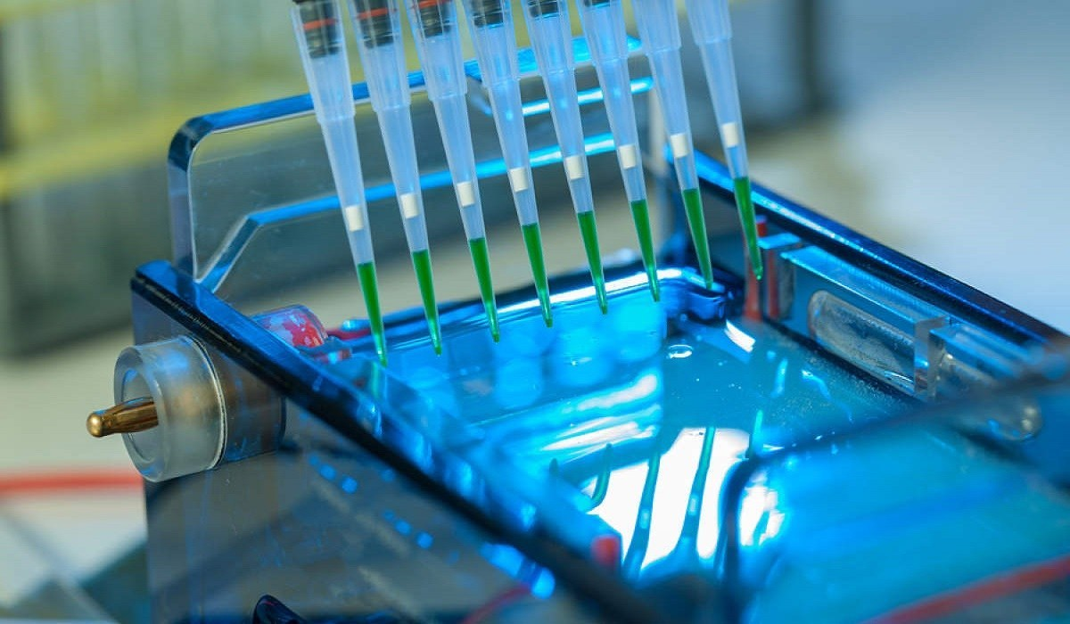 Electrophoresis Market'