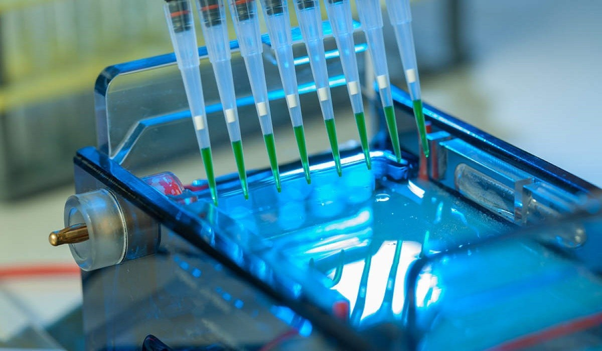 Electrophoresis Market