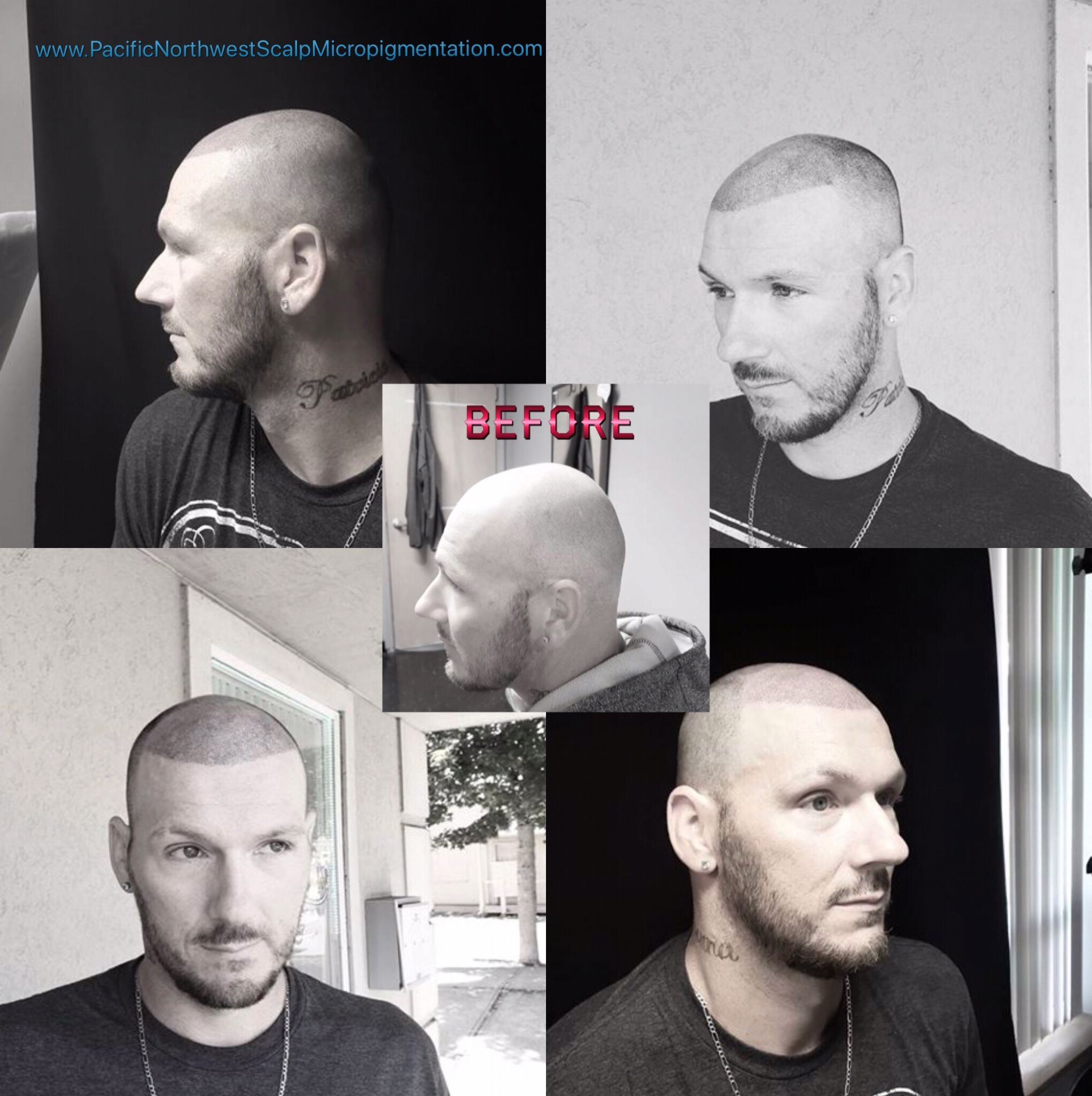Pacific Northwest Scalp Micropigmentation Logo