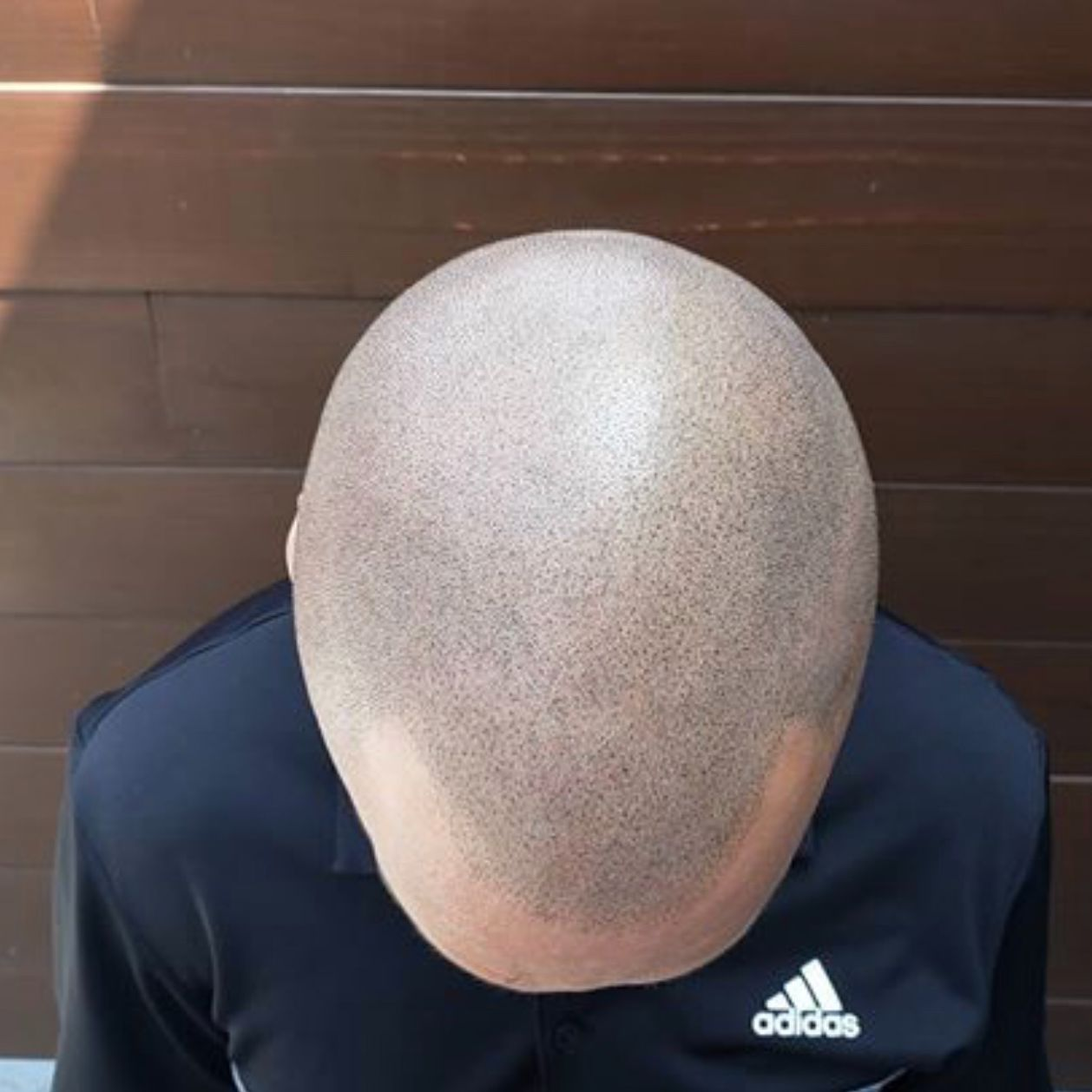 Head Tattoo'