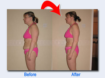 weight loss before an after'