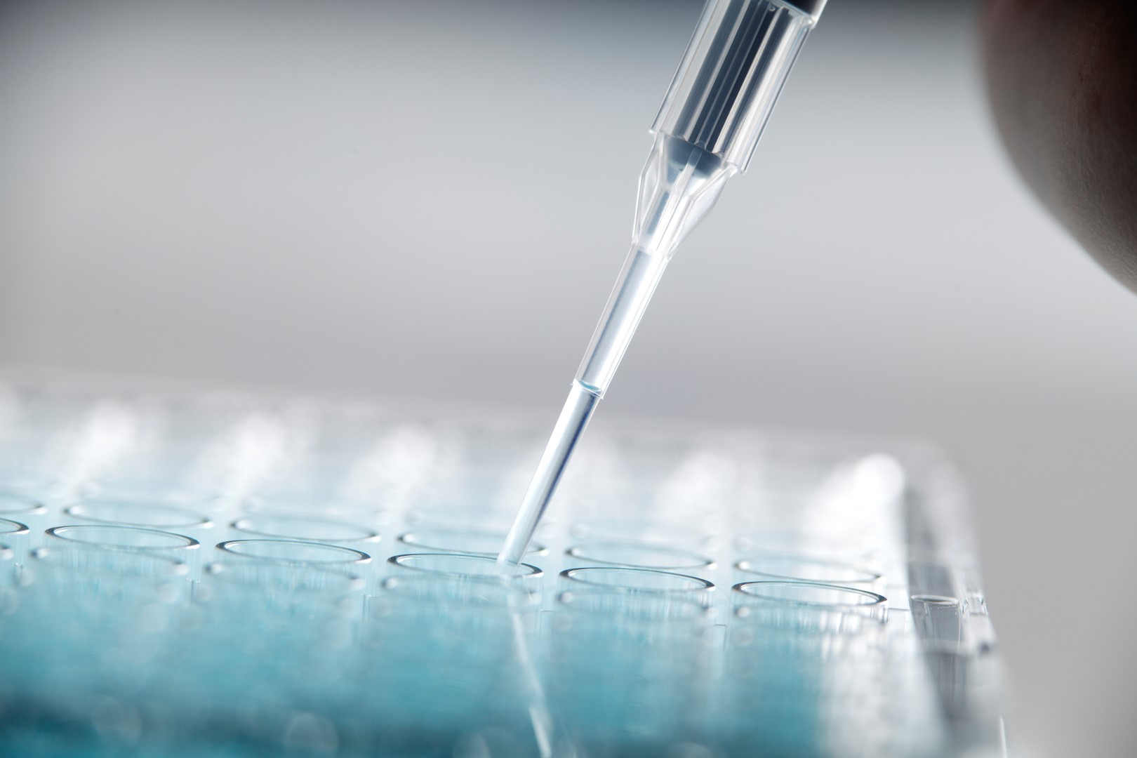 Viral Testing Market'