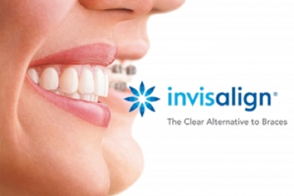 Invisalign'