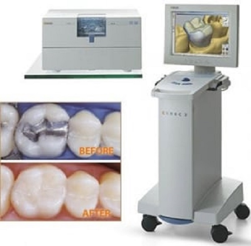 Periodontal Services'
