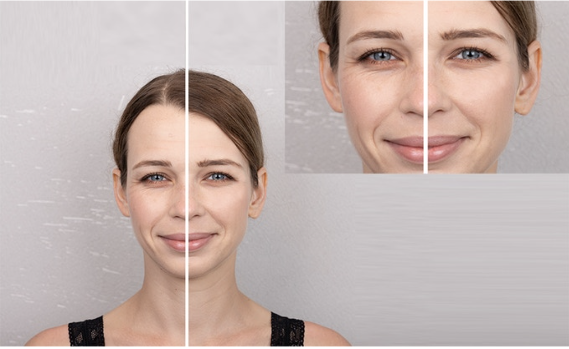 Comper Launches Skin Care Super Device on Kickstarter'