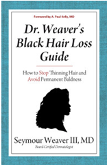 Black Hair Loss Guide'