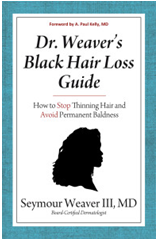 Black Hair Loss Guide