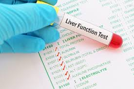 Liver Function Tests'