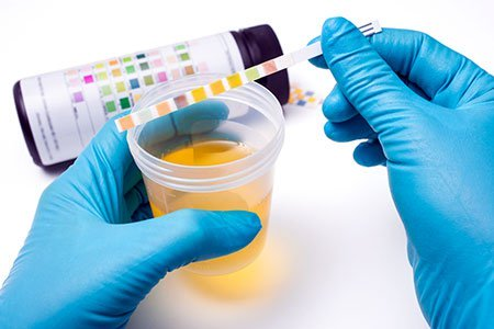 Clinical Urine Testing'