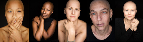 Facing Chemo by Robert Houser'
