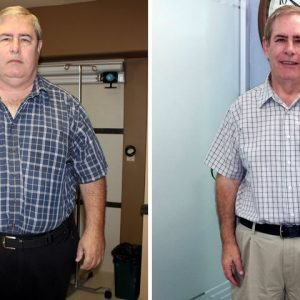 Bariatric Surgery In Mexico'