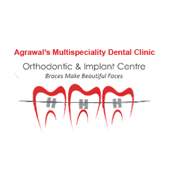 Company Logo For Dr. Chintan Agrawal | Braces Specialists in'