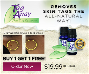 Tag Away Skin Tag Treatment Offer'