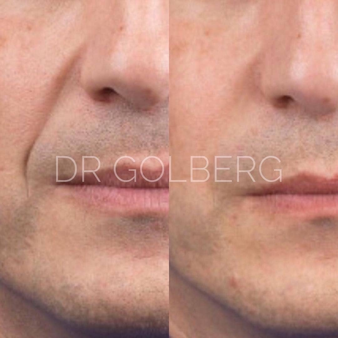 Company Logo For Vampire Facial'