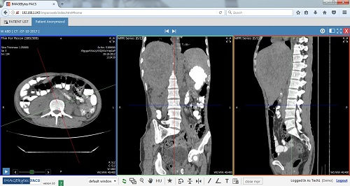 Radiology Software Market