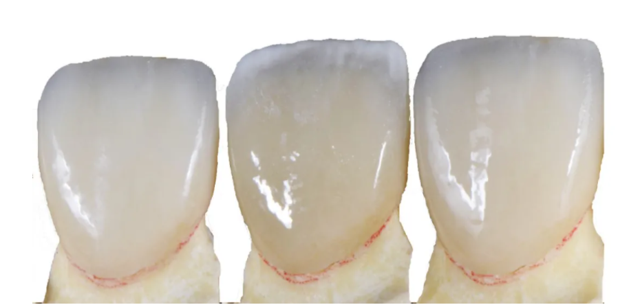 Aidite Launches New Product: Biomic Zirconia Veneer Solution