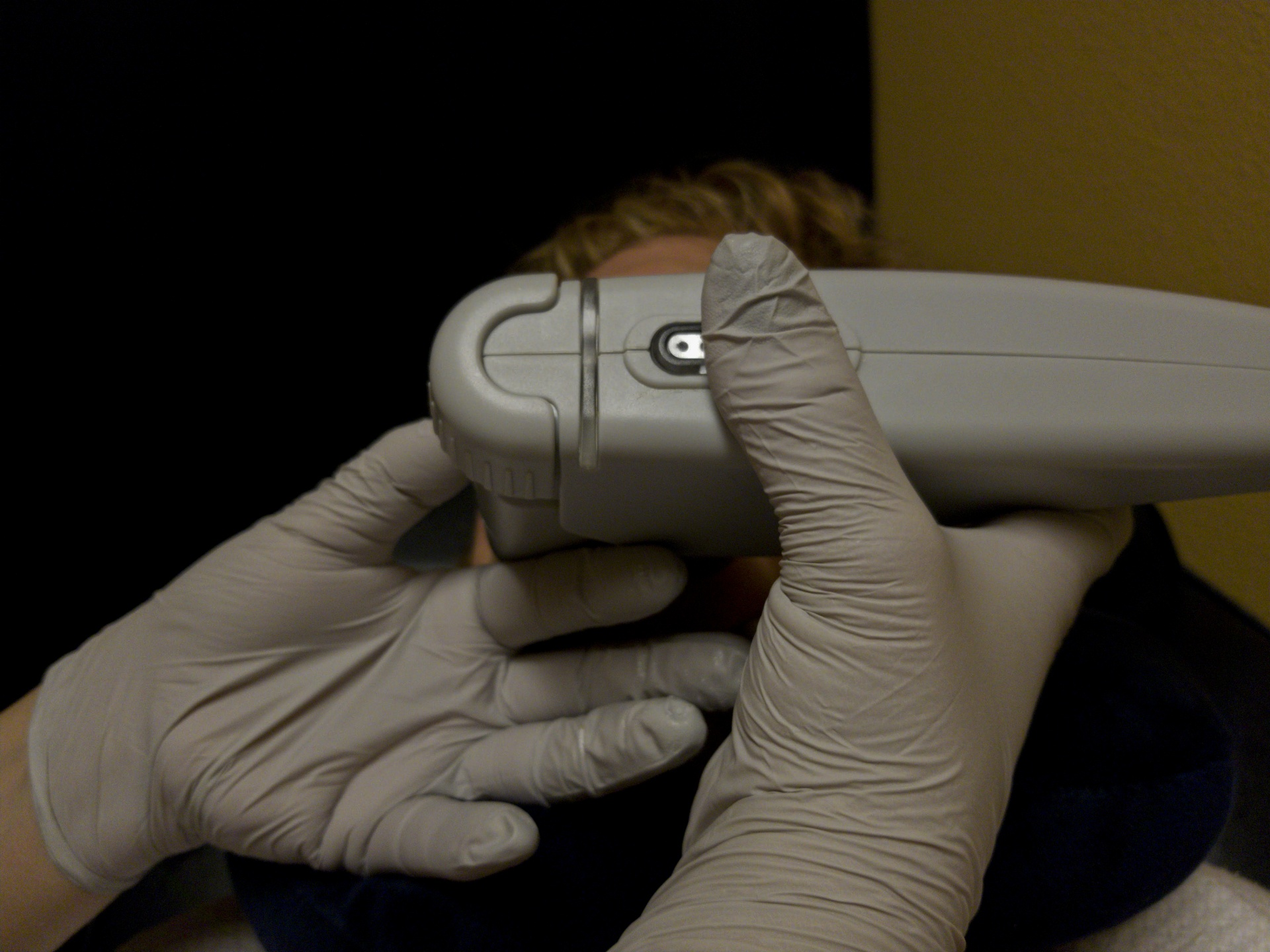 Non-Surgical Skin Tightening