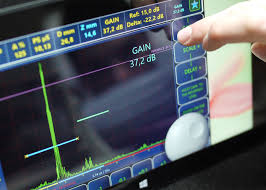 Ultrasonic Testing Market Next Big Thing | Major Giants Olym