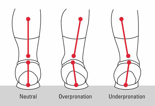 Overpronation &amp; Underpronation'