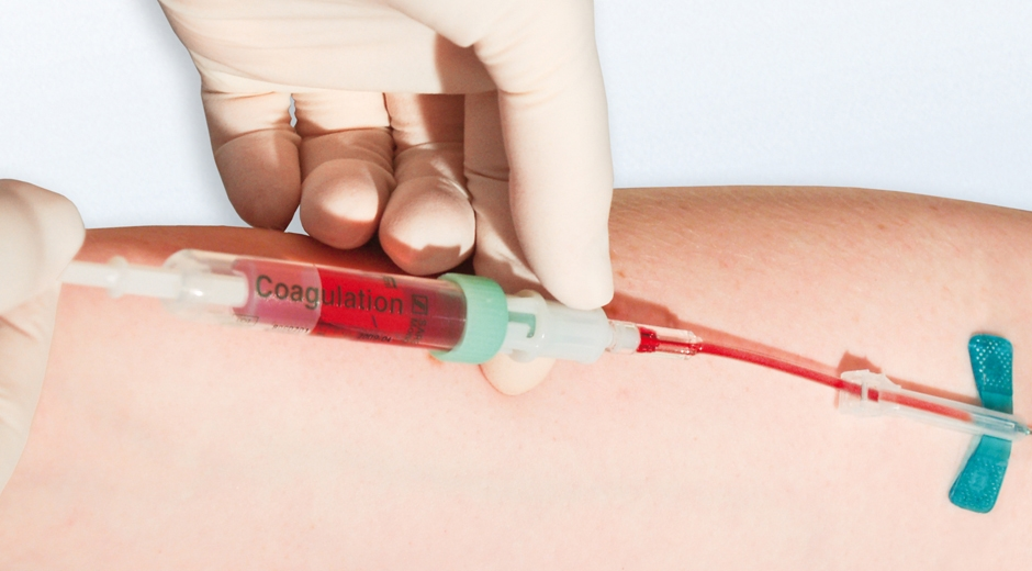 Blood Collection Market Is Thriving Worldwide | Medtronic, F'