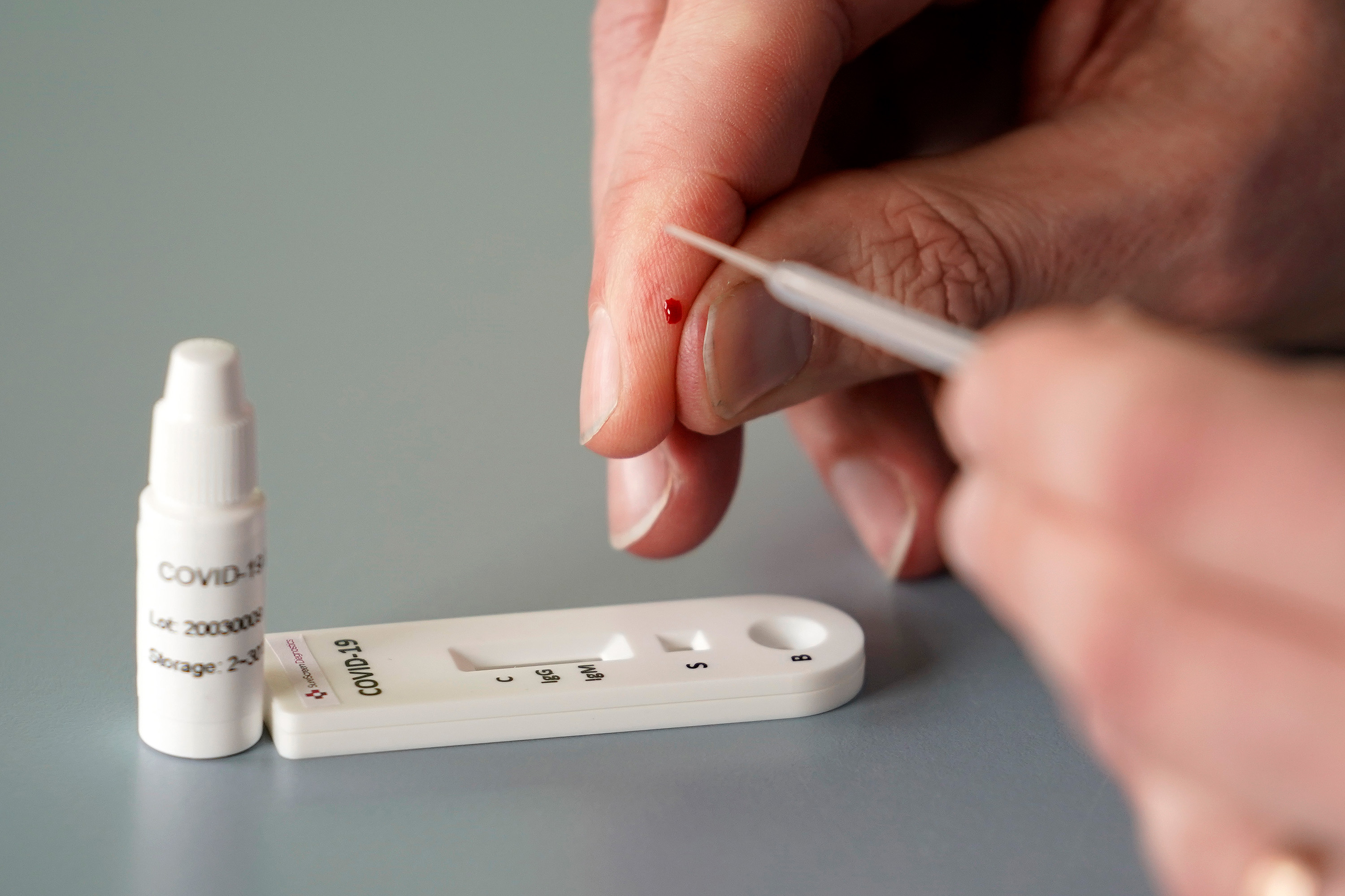 Coronavirus Disease 2020 Test Kit Market'