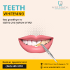 Teeth Whitening Treatment'