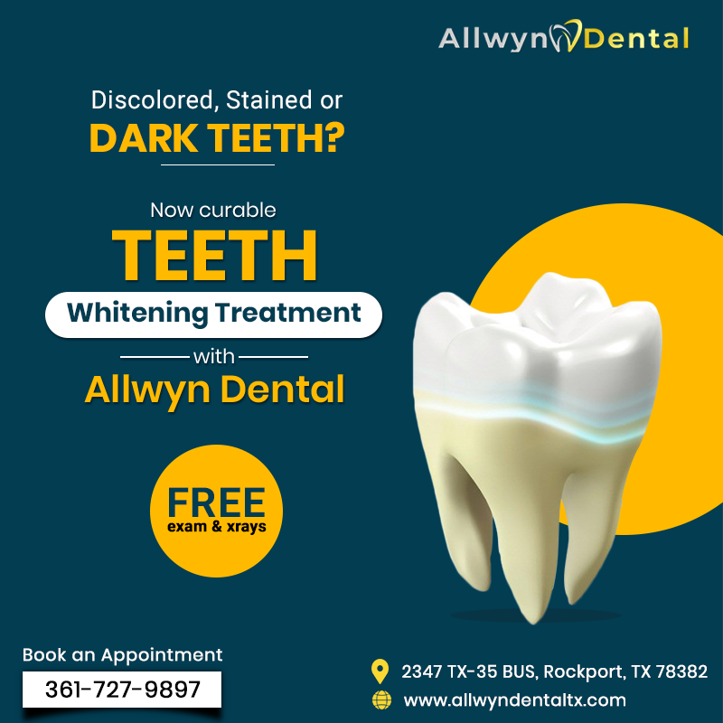 Teeth Whitening Treatment'