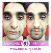 Jaw Surgery Hospital in India'