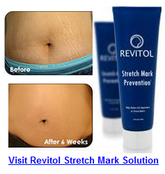 Revitol Stretch Mark Cream'