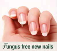 Fungus Free Nails'