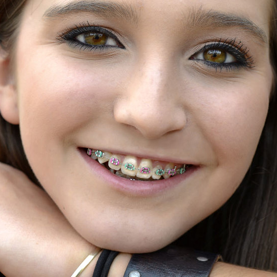 Smile Mock Up'