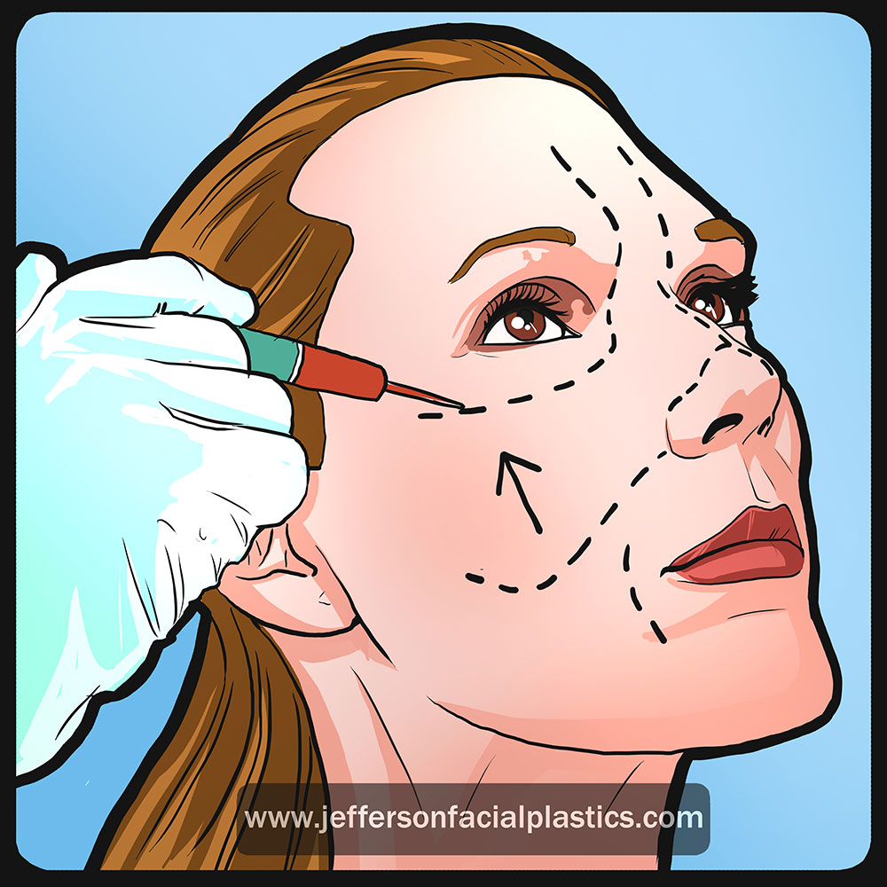 Jefferson Facial Plastics