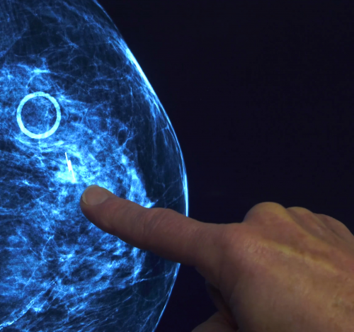 Intermountain Healthcare Mammograms'