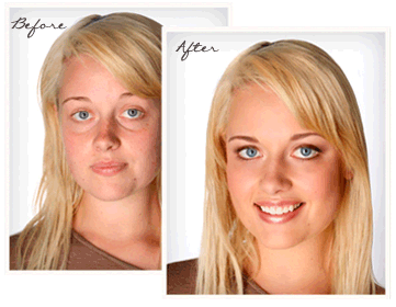 Dermasis Before After'