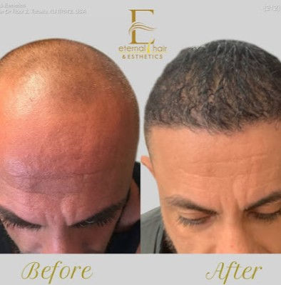 Company Logo For Eternal Hair & Esthetics'