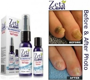 Zeta Clear Nail Fungus'