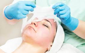 Skin Care Peels Market Growing Popularity and Emerging Trend