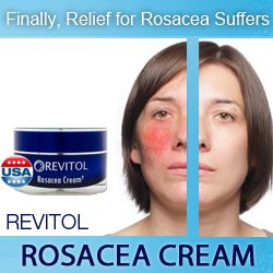 Rosacea Cream'